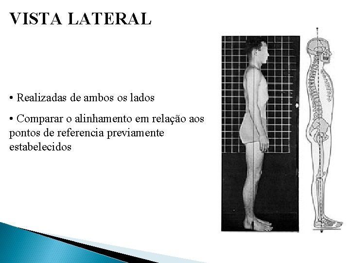 VISTA LATERAL • Realizadas de ambos os lados • Comparar o alinhamento em relação