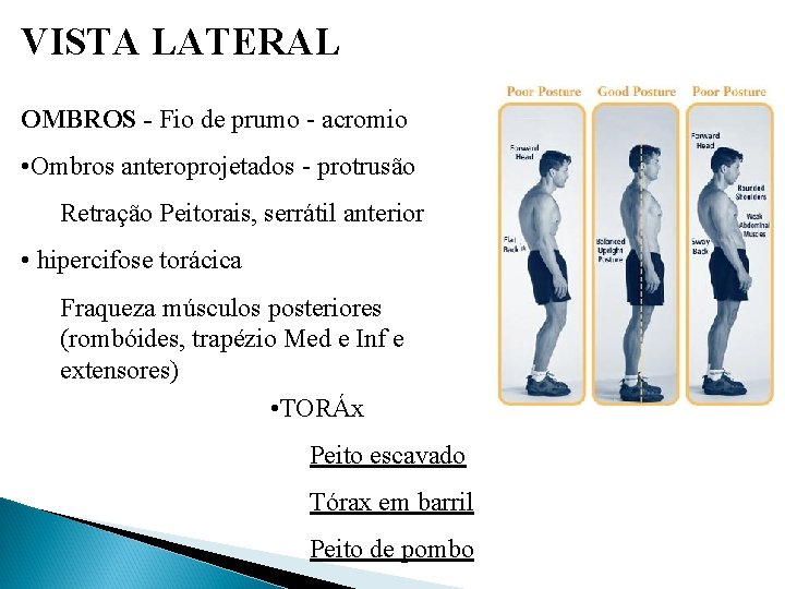 VISTA LATERAL OMBROS - Fio de prumo - acromio • Ombros anteroprojetados - protrusão