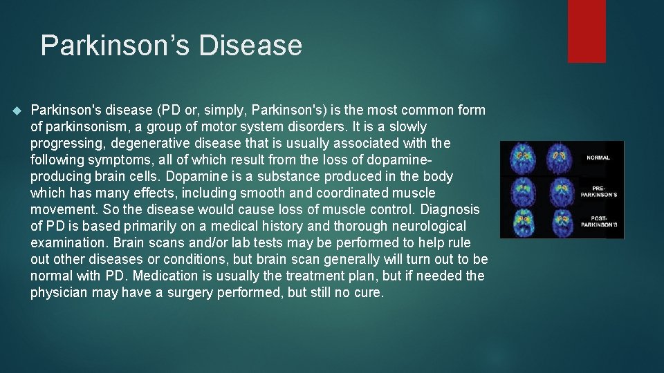 Parkinson’s Disease Parkinson's disease (PD or, simply, Parkinson's) is the most common form of
