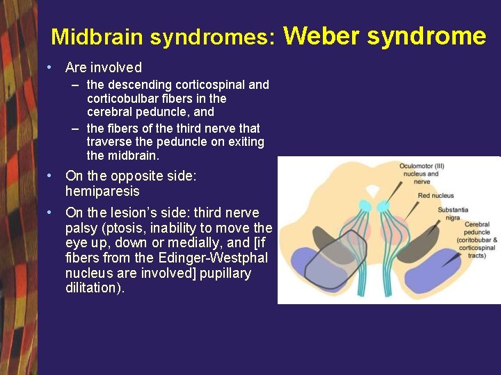 Midbrain syndromes: Weber syndrome • Are involved – the descending corticospinal and corticobulbar fibers