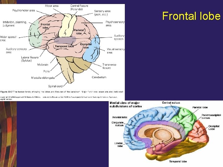 Frontal lobe 