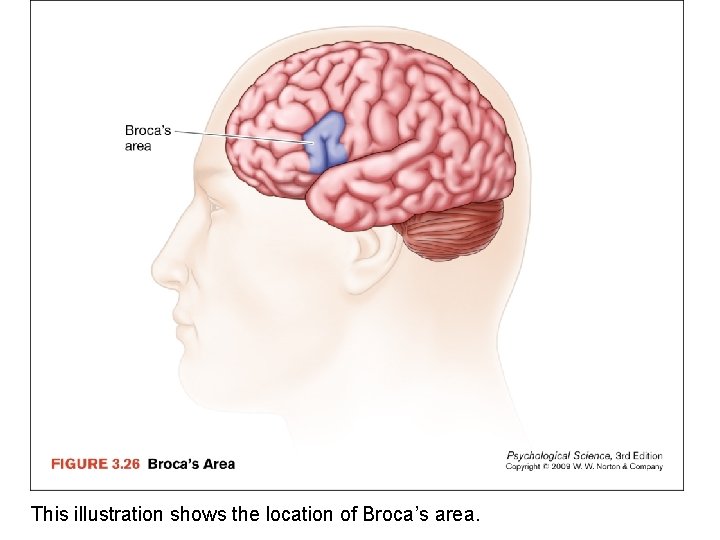 This illustration shows the location of Broca’s area. 