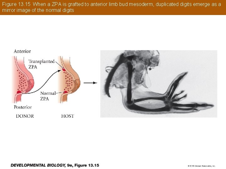 Figure 13. 15 When a ZPA is grafted to anterior limb bud mesoderm, duplicated