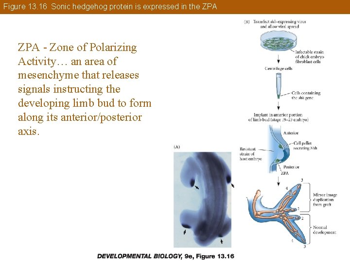 Figure 13. 16 Sonic hedgehog protein is expressed in the ZPA - Zone of