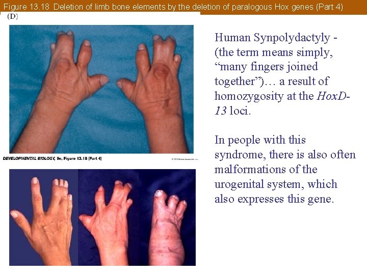 Figure 13. 18 Deletion of limb bone elements by the deletion of paralogous Hox