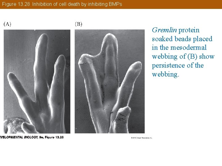 Figure 13. 28 Inhibition of cell death by inhibiting BMPs Gremlin protein soaked beads
