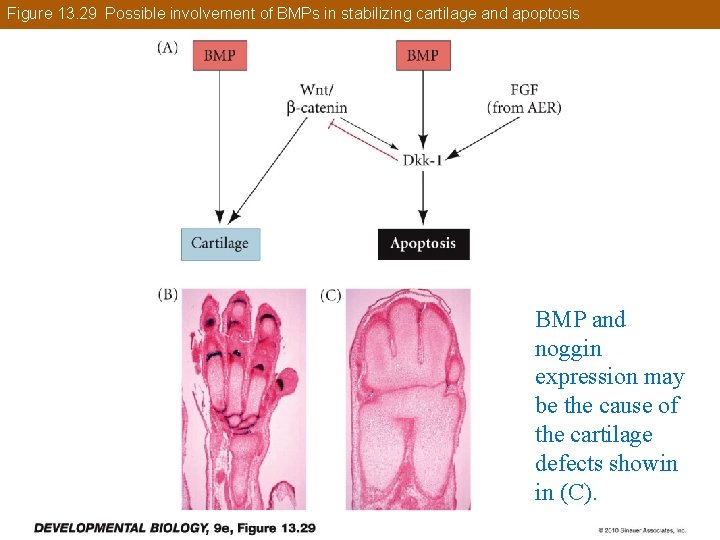 Figure 13. 29 Possible involvement of BMPs in stabilizing cartilage and apoptosis BMP and