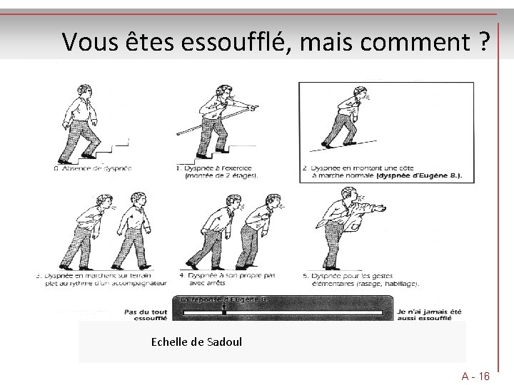 Vous êtes essoufflé, mais comment ? Echelle de Sadoul A - 16 