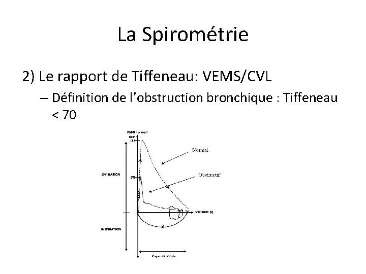 La Spirométrie 2) Le rapport de Tiffeneau: VEMS/CVL – Définition de l’obstruction bronchique :