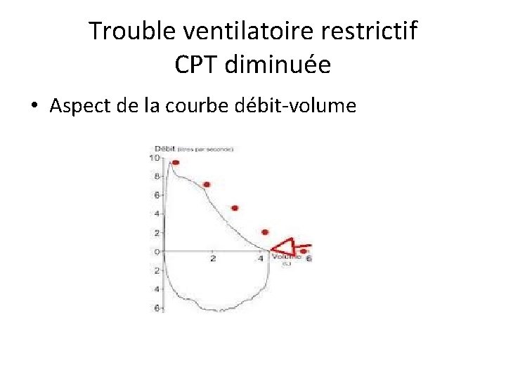 Trouble ventilatoire restrictif CPT diminuée • Aspect de la courbe débit-volume 