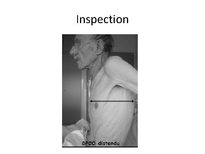 Inspection 