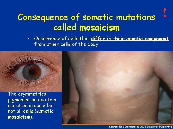 Consequence of somatic mutations called mosaicism ! • Occurrence of cells that differ in