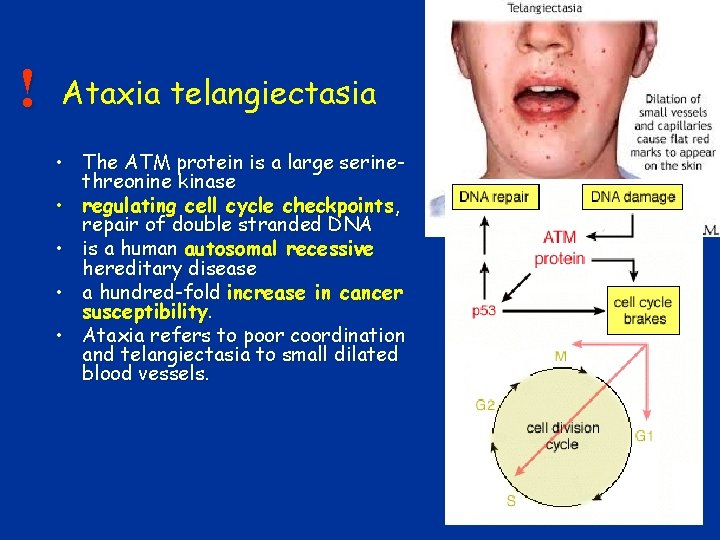 ! Ataxia telangiectasia • The ATM protein is a large serinethreonine kinase • regulating