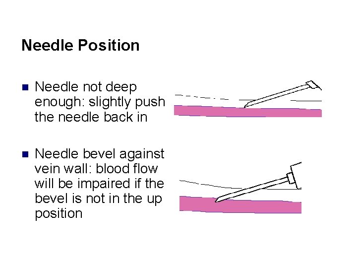 Needle Position n Needle not deep enough: slightly push the needle back in n