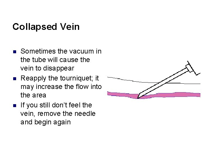 Collapsed Vein n Sometimes the vacuum in the tube will cause the vein to