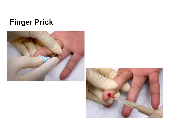 Finger Prick 