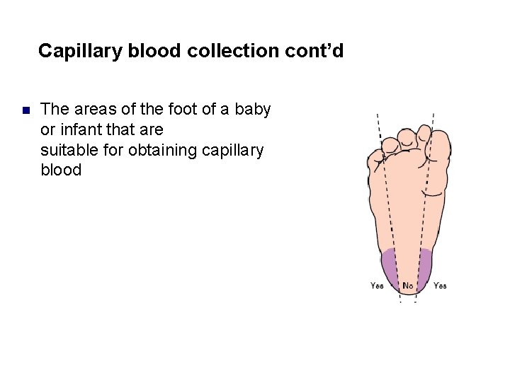 Capillary blood collection cont’d n The areas of the foot of a baby or