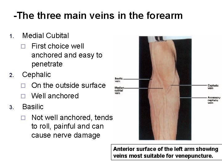 -The three main veins in the forearm 1. 2. 3. Medial Cubital ¨ First