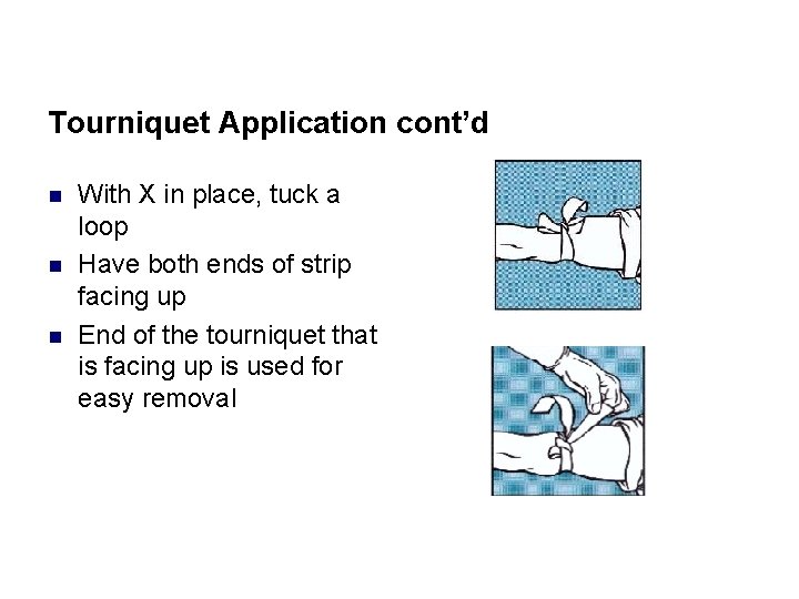 Tourniquet Application cont’d n n n With X in place, tuck a loop Have