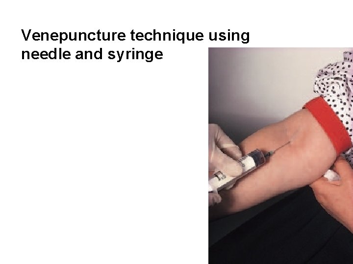 Venepuncture technique using needle and syringe 