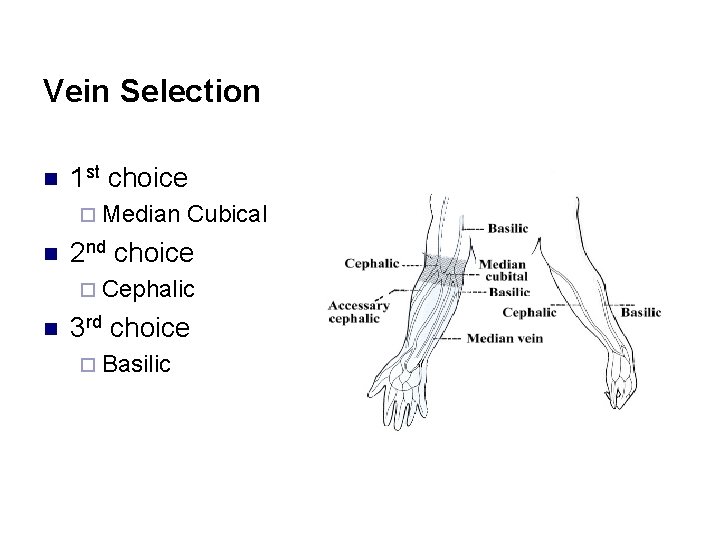 Vein Selection n 1 st choice ¨ Median n Cubical 2 nd choice ¨