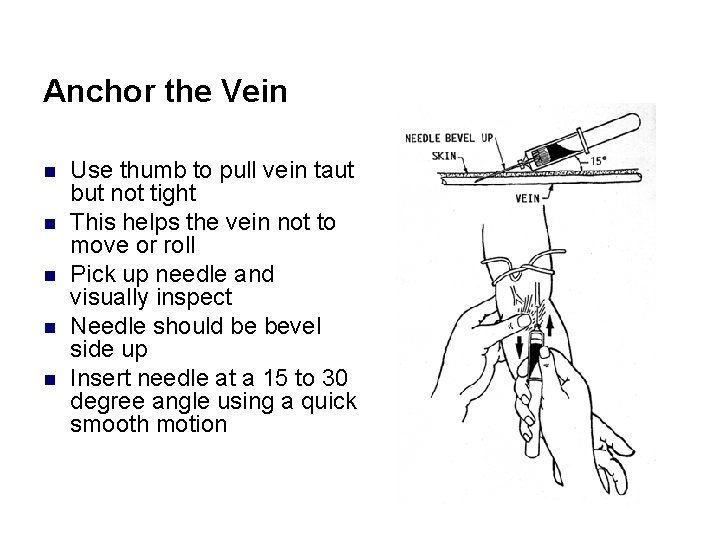 Anchor the Vein n n Use thumb to pull vein taut but not tight
