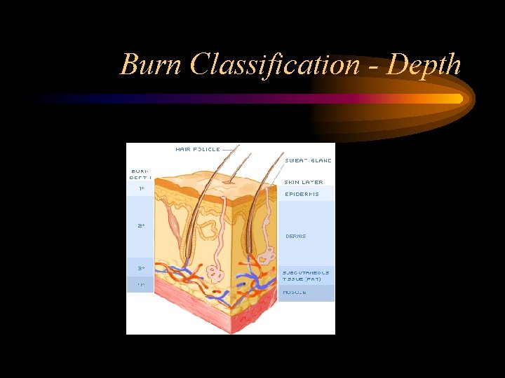 Burn Classification - Depth 