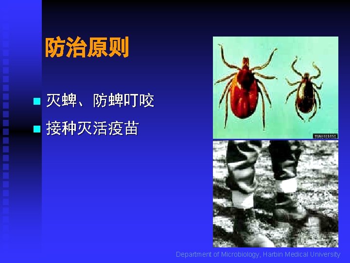 防治原则 n 灭蜱、防蜱叮咬 n 接种灭活疫苗 Department of Microbiology, Harbin Medical University 
