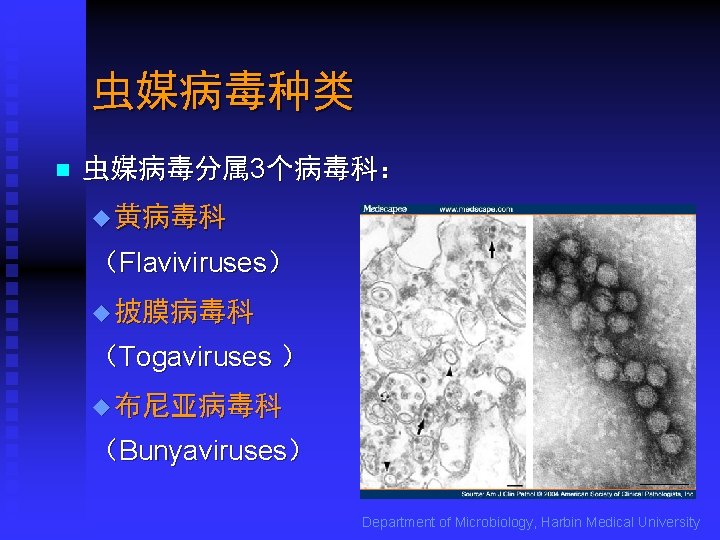 虫媒病毒种类 n 虫媒病毒分属 3个病毒科： u 黄病毒科 （Flaviviruses） u 披膜病毒科 （Togaviruses ） u 布尼亚病毒科 （Bunyaviruses）