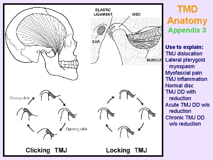 TMD Anatomy Appendix 3 Use to explain: TMJ dislocation Lateral pterygoid myospasm Myofascial pain