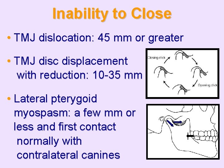 Inability to Close • TMJ dislocation: 45 mm or greater • TMJ disc displacement