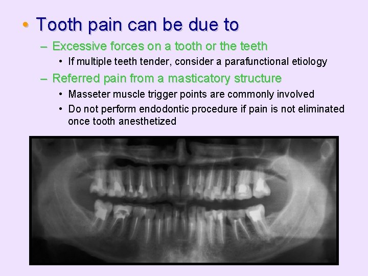  • Tooth pain can be due to – Excessive forces on a tooth