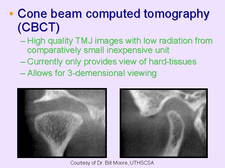  • Cone beam computed tomography (CBCT) – High quality TMJ images with low