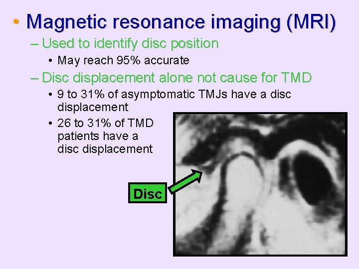  • Magnetic resonance imaging (MRI) – Used to identify disc position • May