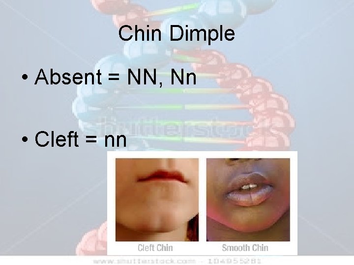 Chin Dimple • Absent = NN, Nn • Cleft = nn 