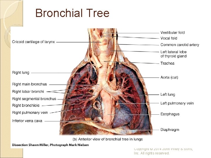 Bronchial Tree Copyright © 2014 John Wiley & Sons, Inc. All rights reserved. 
