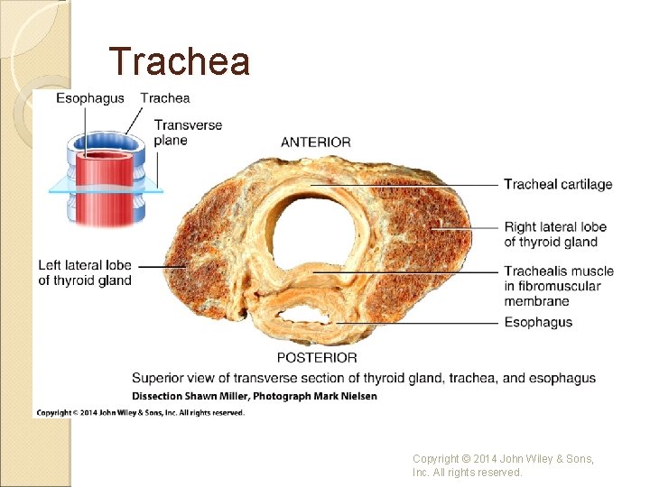 Trachea Copyright © 2014 John Wiley & Sons, Inc. All rights reserved. 