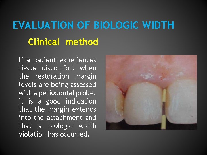 EVALUATION OF BIOLOGIC WIDTH Clinical method If a patient experiences tissue discomfort when the