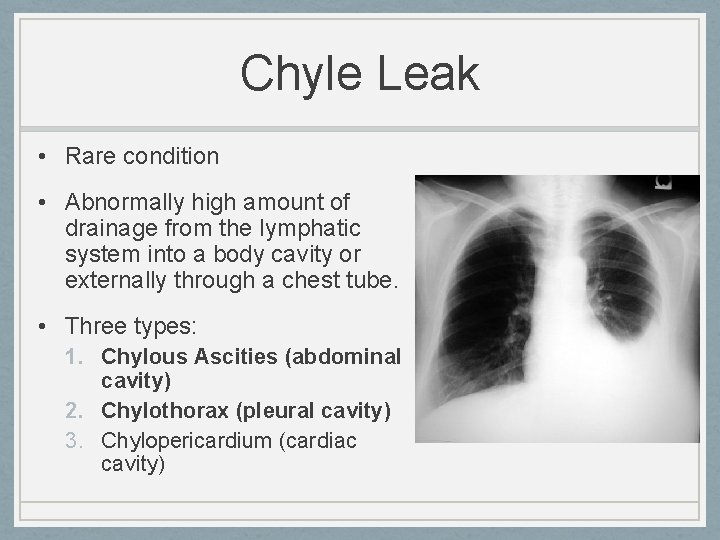 Chyle Leak • Rare condition • Abnormally high amount of drainage from the lymphatic