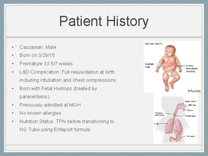 Patient History • Caucasian, Male • Born on 3/29/15 • Premature 33 5/7 weeks