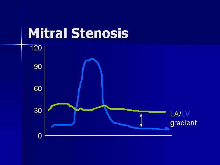 Mitral Stenosis 120 90 60 30 0 LA/LV gradient 