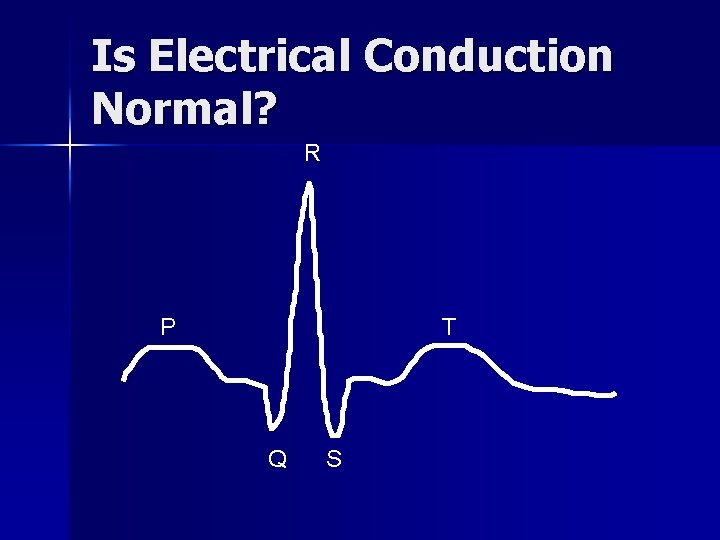 Is Electrical Conduction Normal? R P T Q S 