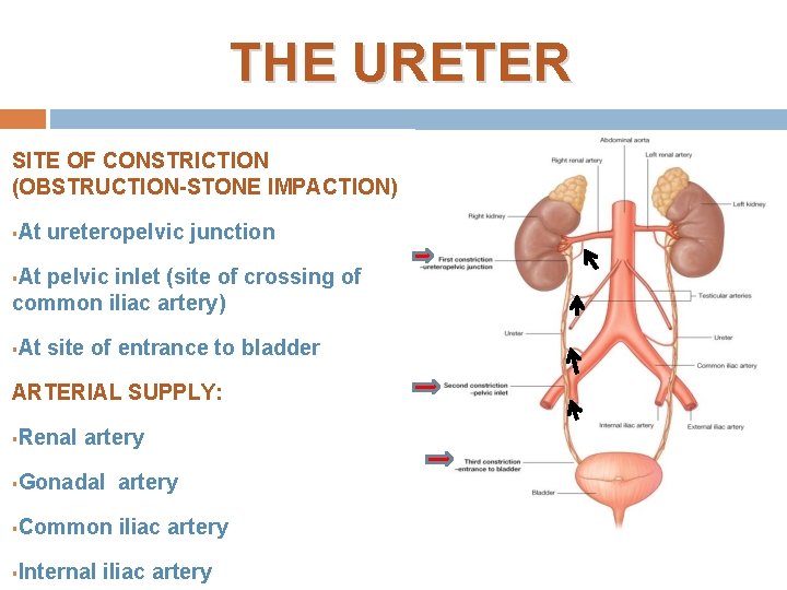 THE URETER SITE OF CONSTRICTION (OBSTRUCTION-STONE IMPACTION) § At ureteropelvic junction At pelvic inlet