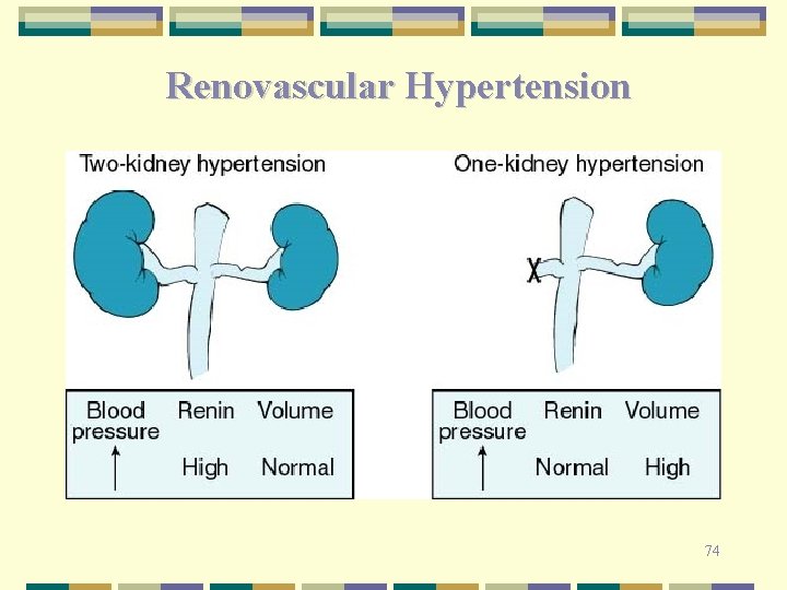 Renovascular Hypertension 74 