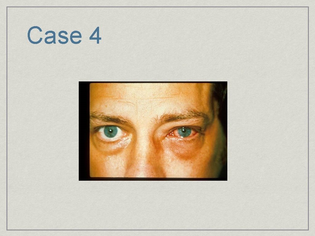 Case 4 