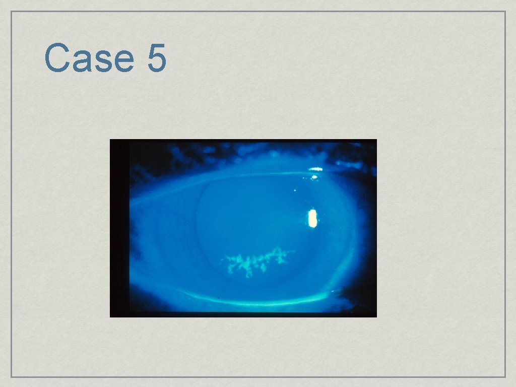 Case 5 