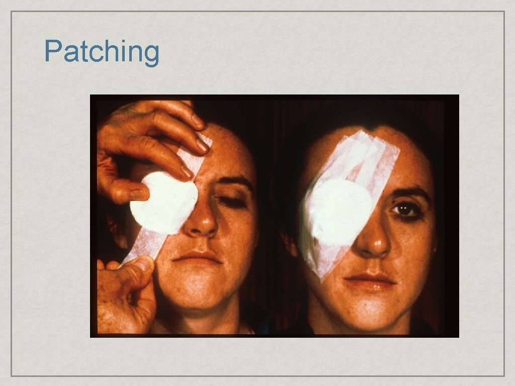 Patching 