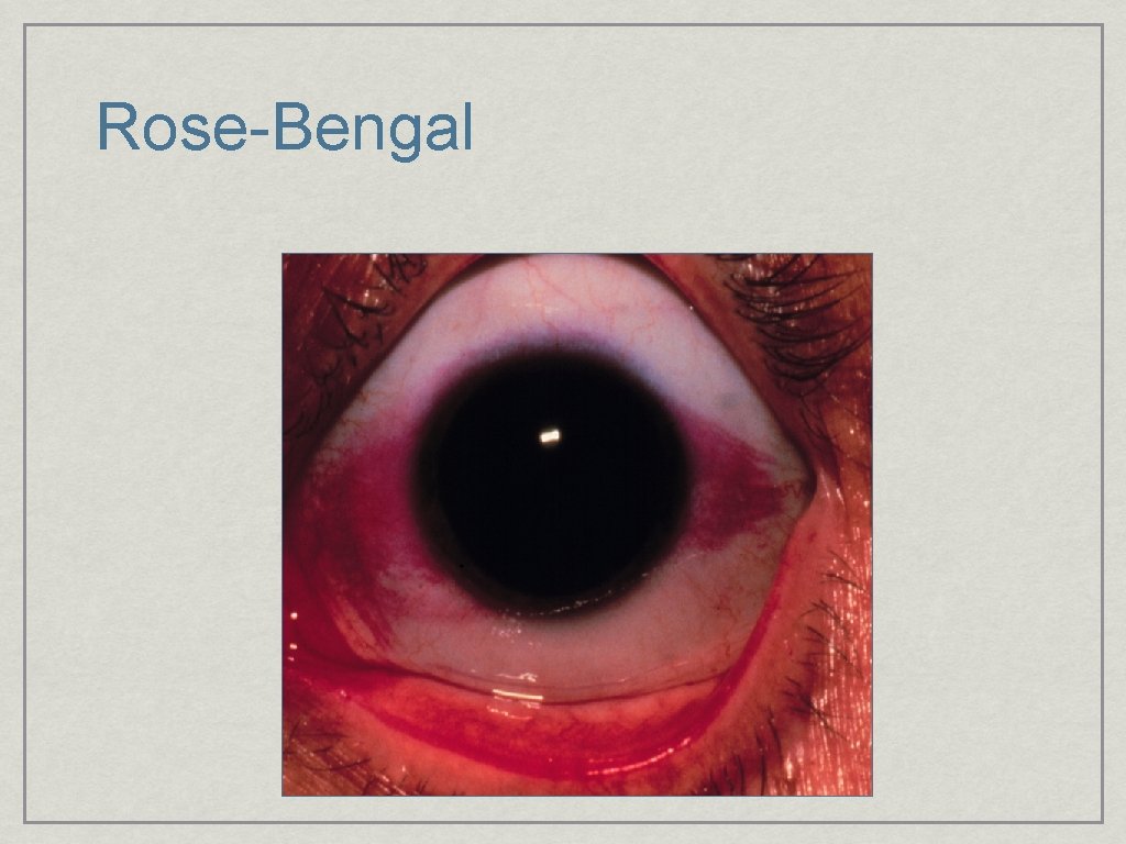 Rose-Bengal 