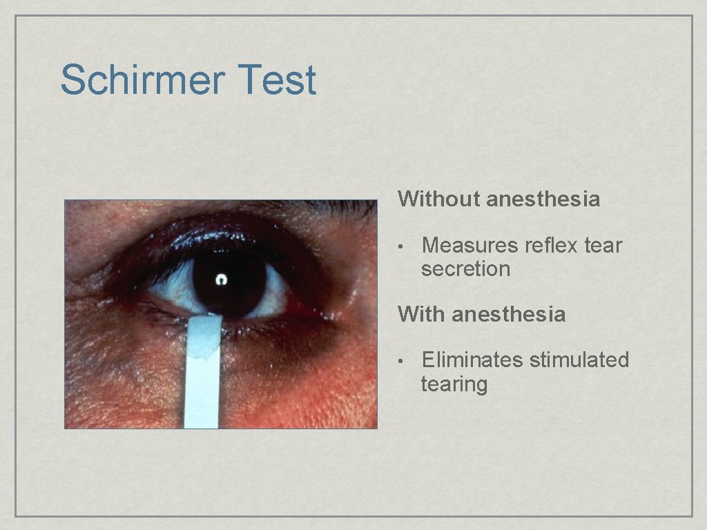 Schirmer Test Without anesthesia • Measures reflex tear secretion With anesthesia • Eliminates stimulated