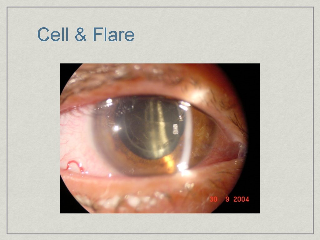 Cell & Flare 